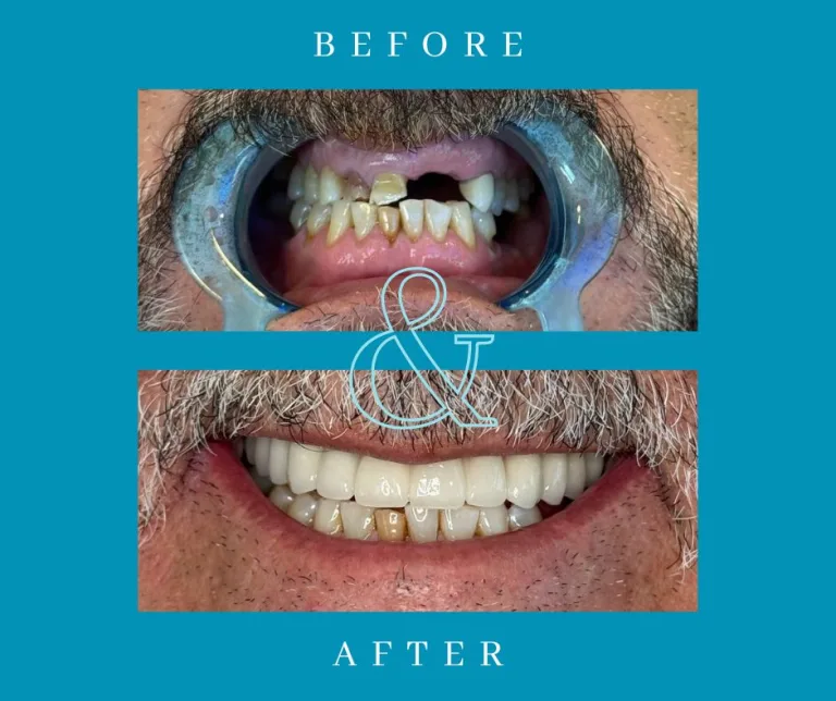 Webster, TX Dental Guide | 7 Ways to Keep Your Smile Healthy Year-Round