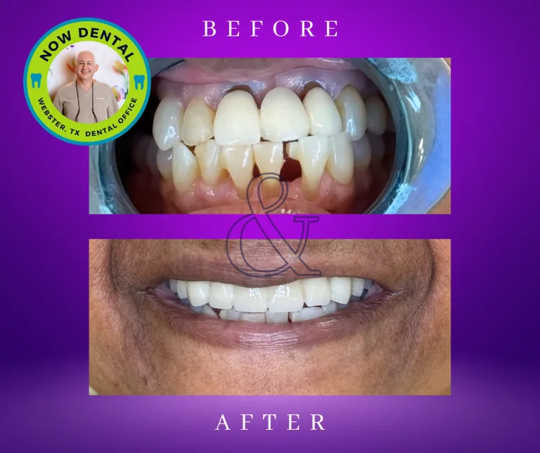 Best Dentist in Webster, TX | How to Choose the Right Dental Office